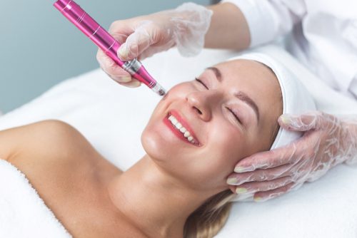 Microneedling: Γιατί πρέπει να το δοκιμάσετε σύμφωνα με τον δερματολόγο